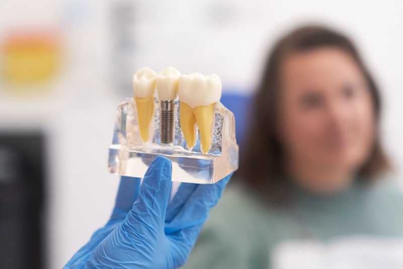 Dental Implants in Westminster, CO: Essential Insights for a Successful Procedure